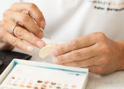 Prothetik und Zahnersatz
